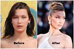 Transformation Journey: Before and After Bella Hadid