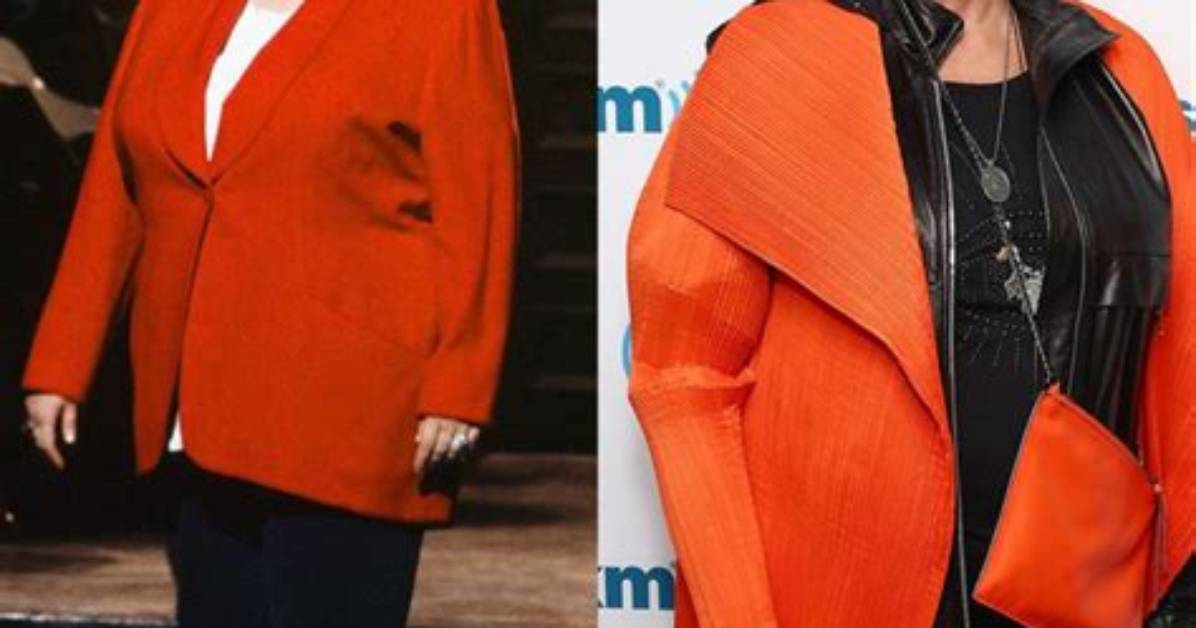 Transformations of a Comedian: Roseanne Before and After Plastic Surgery