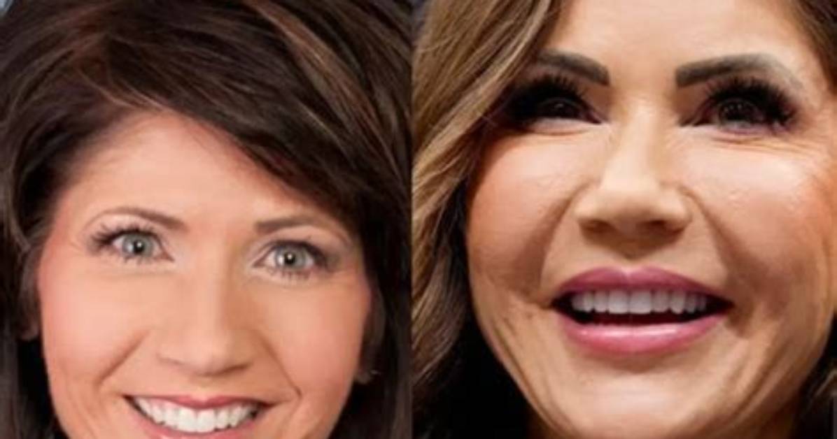 Transformative Journey: Kristi Noem Before and After Pics