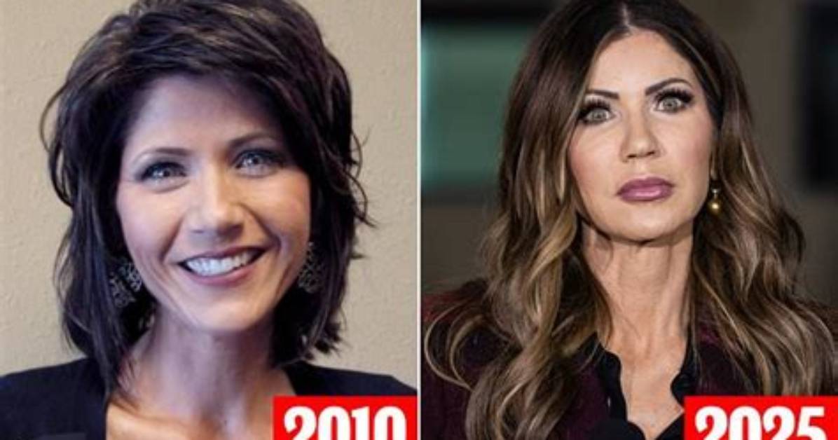 Ultimate Transformation: Kristi Noem's Unseen Before and After Photos