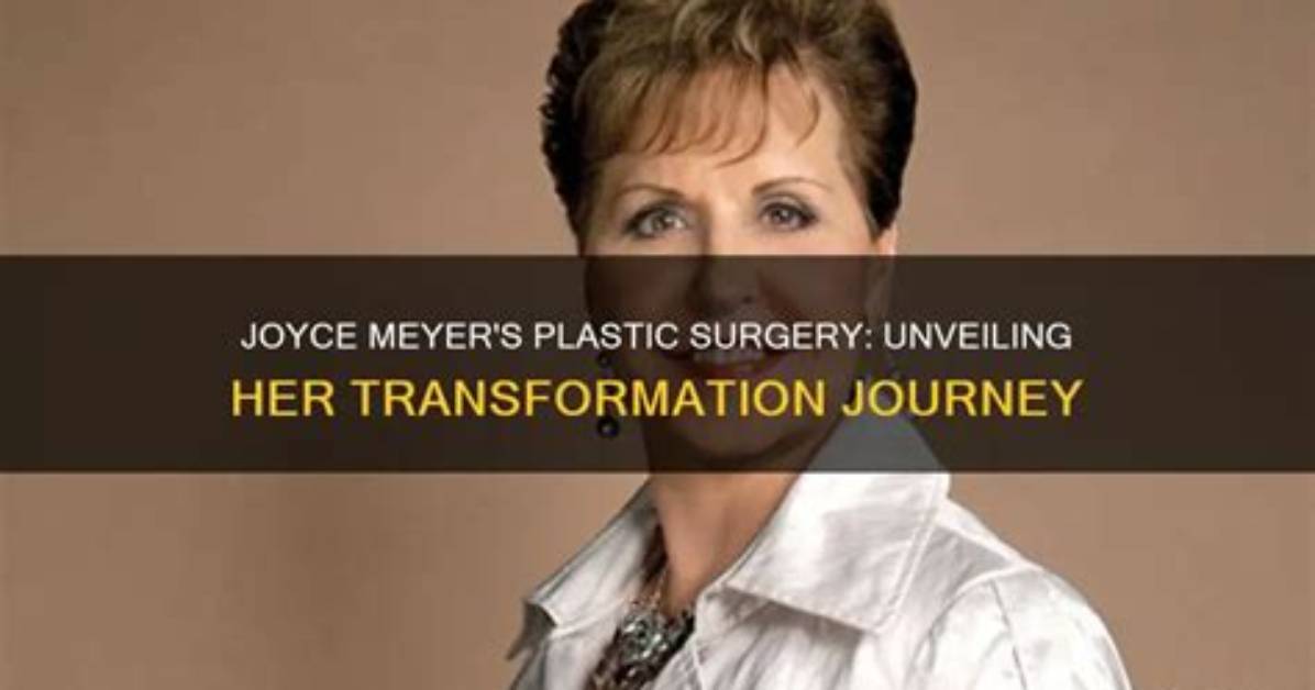 Uncovering Joyce Meyer's Cosmetic Surgery: Unveiling Insights and Surprises