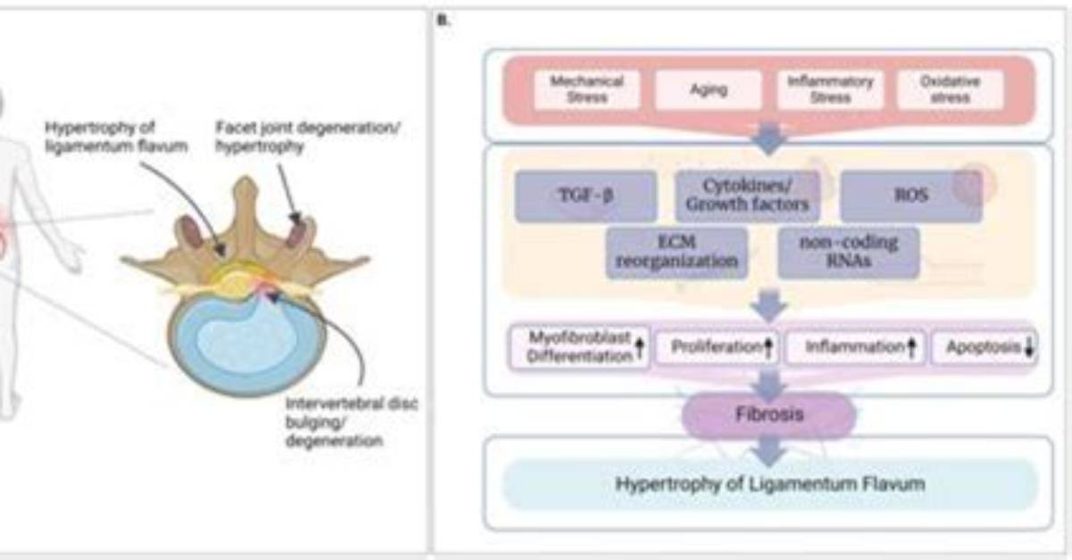 Uncovering the Curious Anatomy of Snot: Measuring Heights
