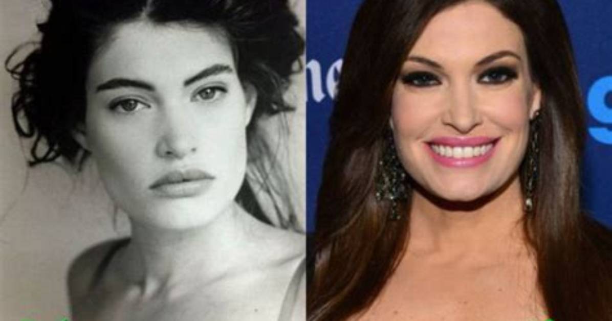 Understanding Kimberly Guilfoyle Before Surgery: a Journey of Transformation