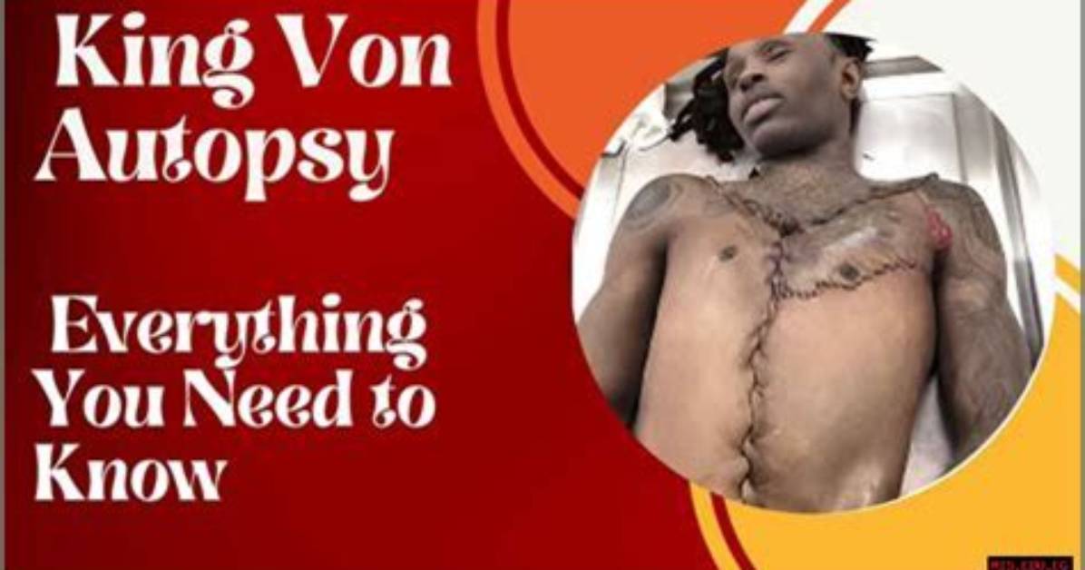 Understanding King Von's Toxicology Report: What Really Happened?