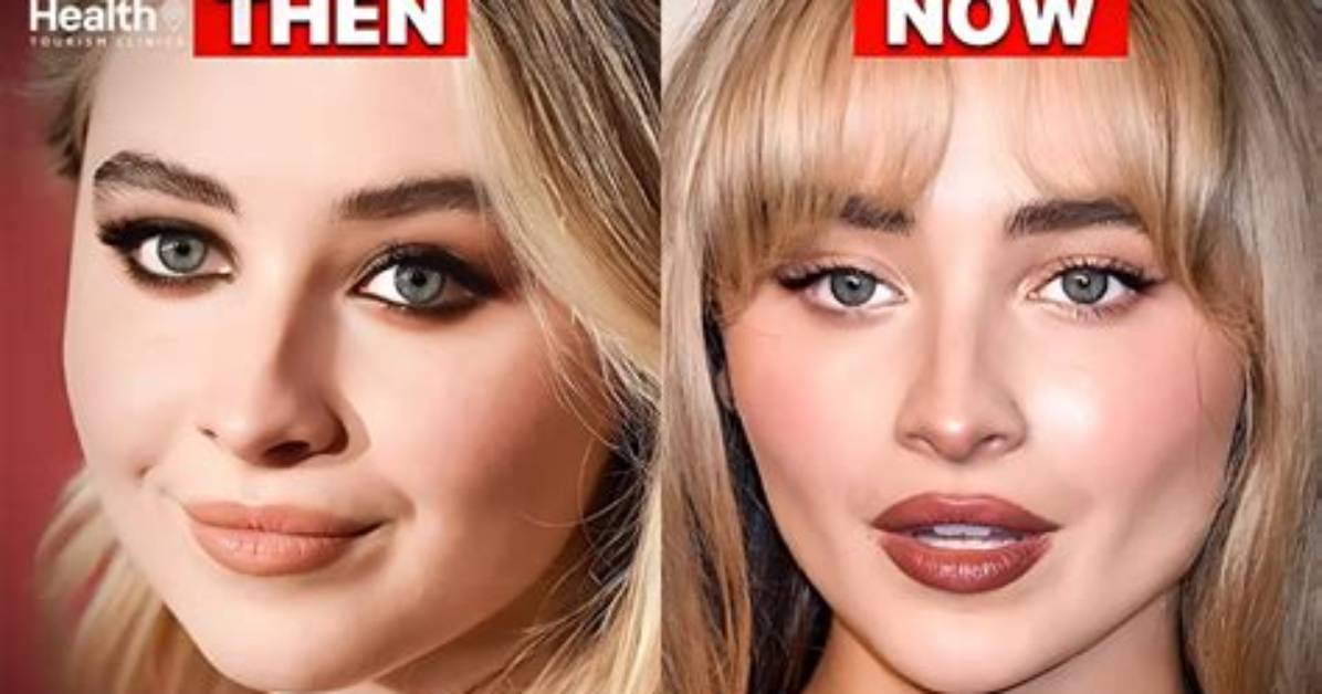 Understanding Sabrina Carpenter's Surgery Journey