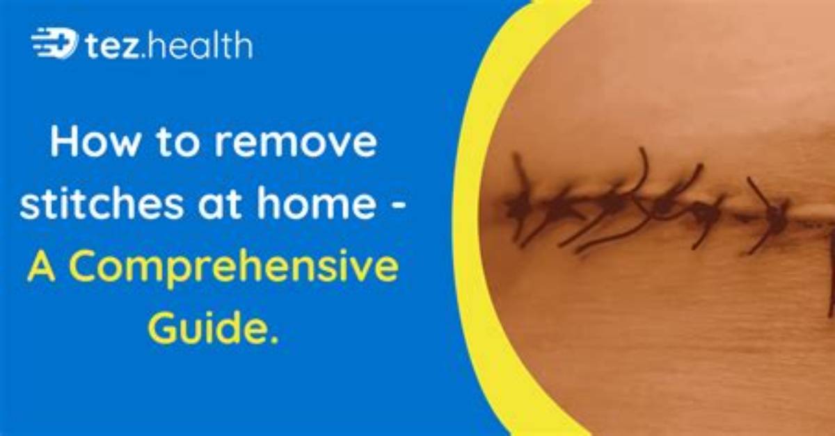 Understanding Stitches Height: a Comprehensive Guide