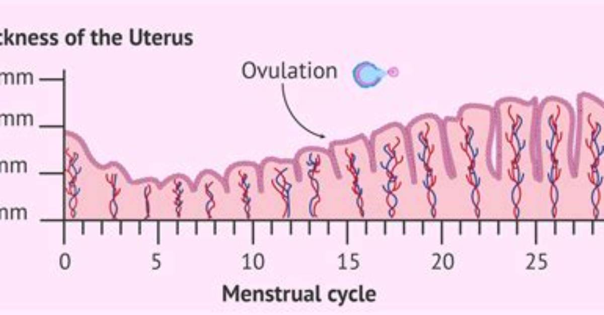 Understanding the Ideal Thickness of Uterine Lining for Successful Ivf: a Comprehensive Guide