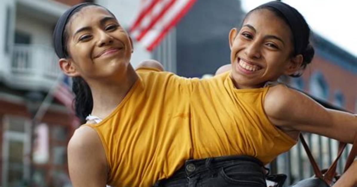 Unraveling the Heartbreaking Tale of Conjoined Twins Abby and Brittany