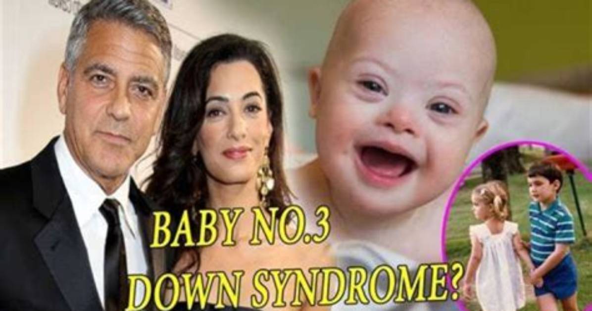 Unraveling the Truth: Does George Clooney Have a Down Syndrome Child?