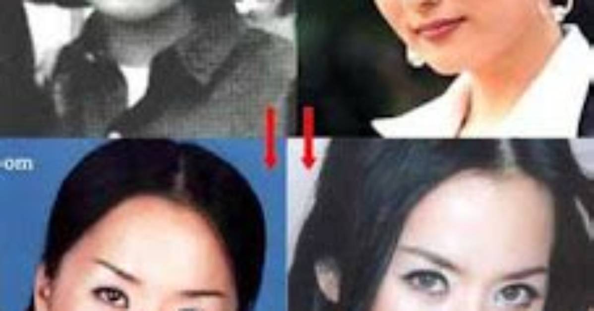 Unraveling Uhm Jung Hwa's Plastic Surgery Journey
