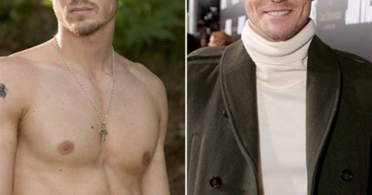 Unveiling the Secrets of Chad Michael Murray's Nose: Uncovering the Truth