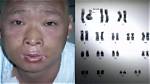 Unveiling the Secrets of Hisachi Ouchi Skin
