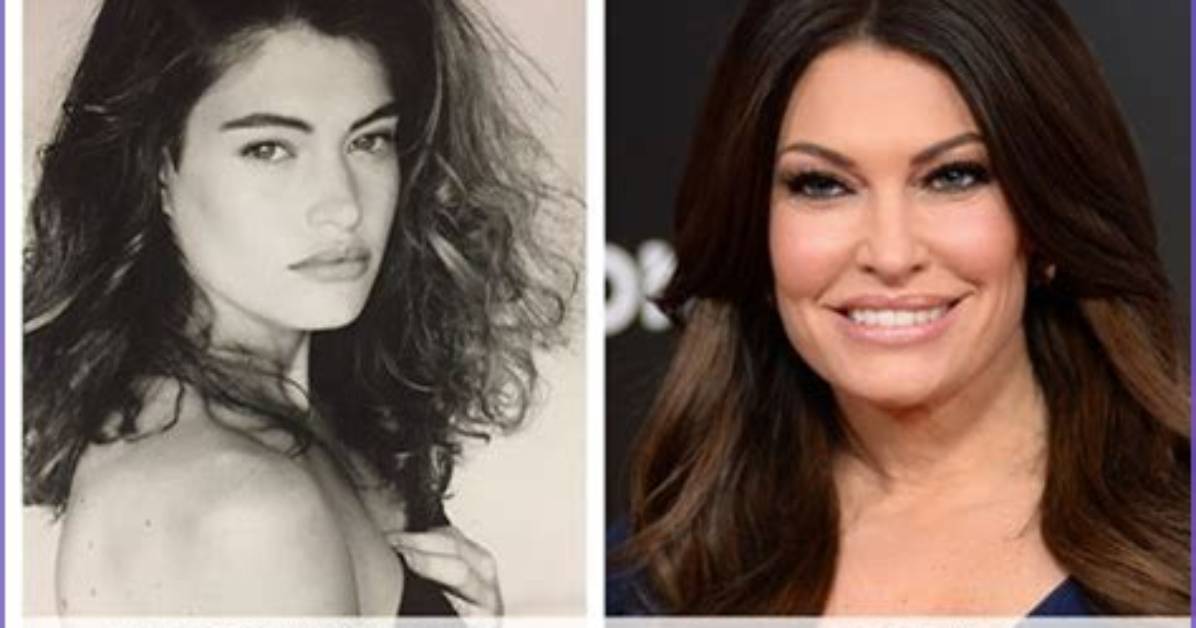 Unveiling the Transformation: Kimberly Guilfoyle Before and After Photos