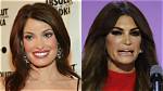 Unveiling the Truth Behind Kimberly Guilfoyle Lip Surgery