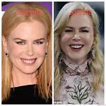 Unveiling the Truth Behind Nicole Kidman's Facelift: a Journey Through Time