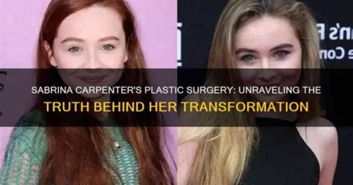 Unveiling the Truth: Did Sabrina Get Plastic Surgery?