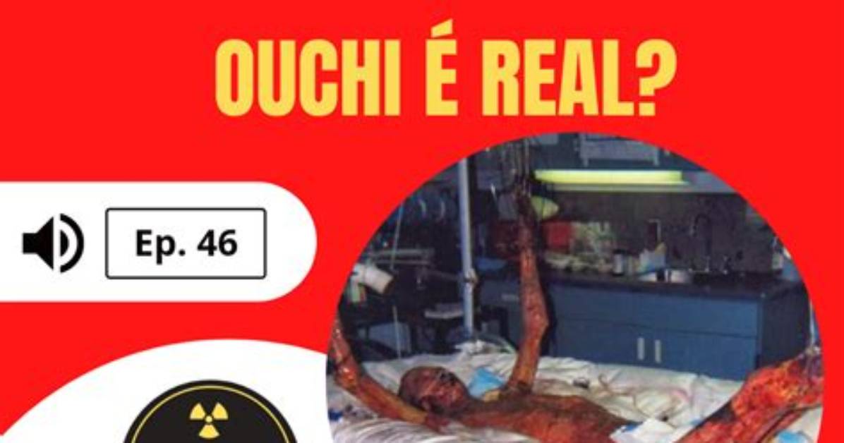 Unveiling the Truth: Hisashi Ouchi Real Picture
