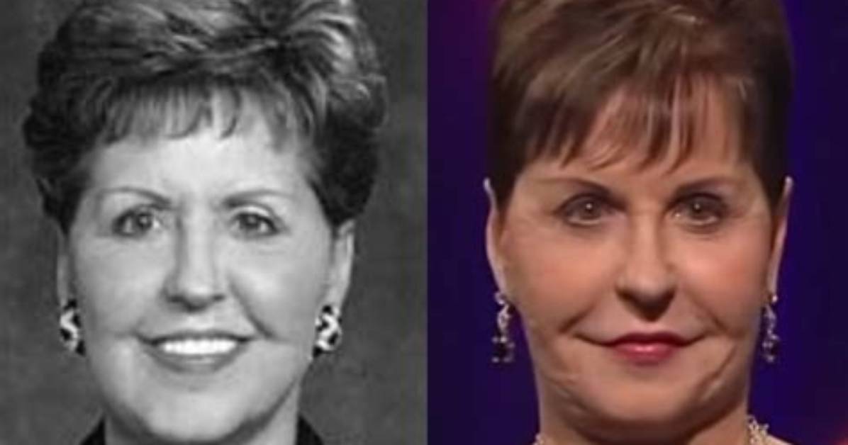 Unveiling the Truth: Joyce Meyer Face Surgery