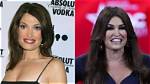 Unveiling the Truth: Kim Guilfoyle's Plastic Surgery Journey