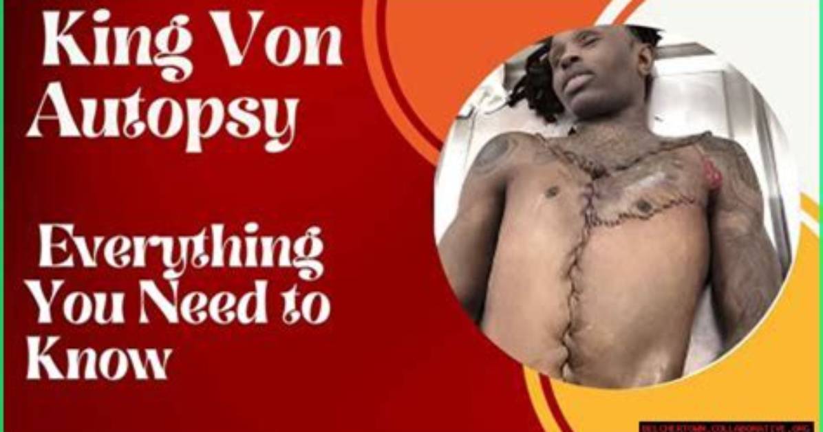 Unveiling the Truth: King Von Autopsy P Explained