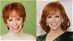 Unveiling the Truth: Reba's Plastic Surgery Journey