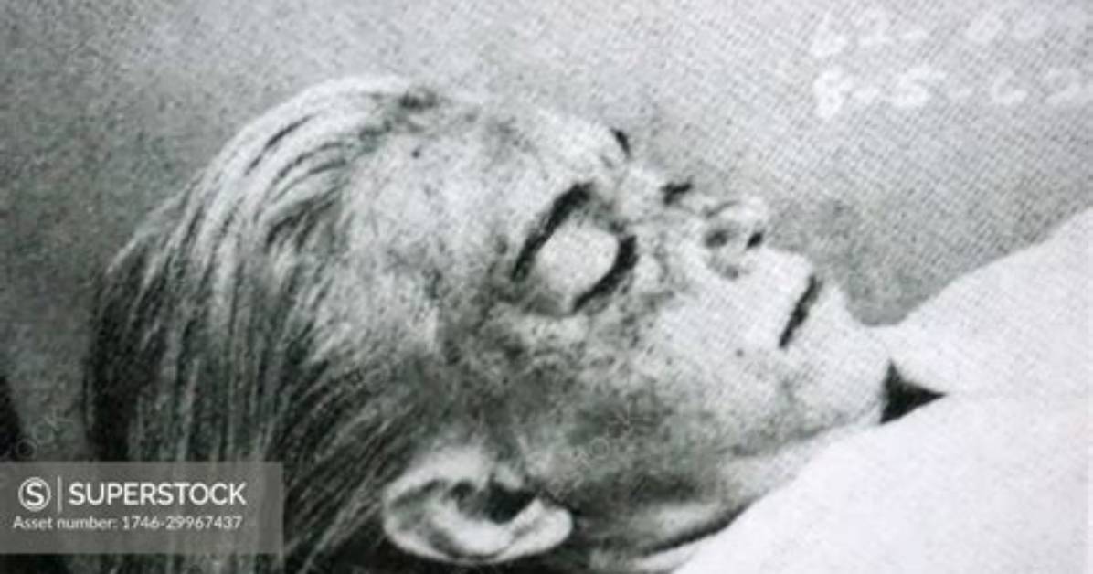 Unveiling the Truth: the Marilyn Monroe Autopsy