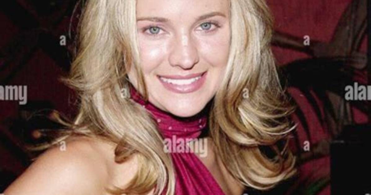Unveiling the Truth: What Did Sharon Case Do to Her Face?