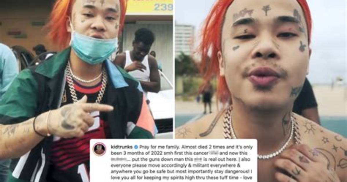 Was Rapper Kid Trunks Shot in the Face?