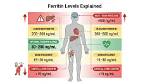 What a High Ferritin Level Indicates
