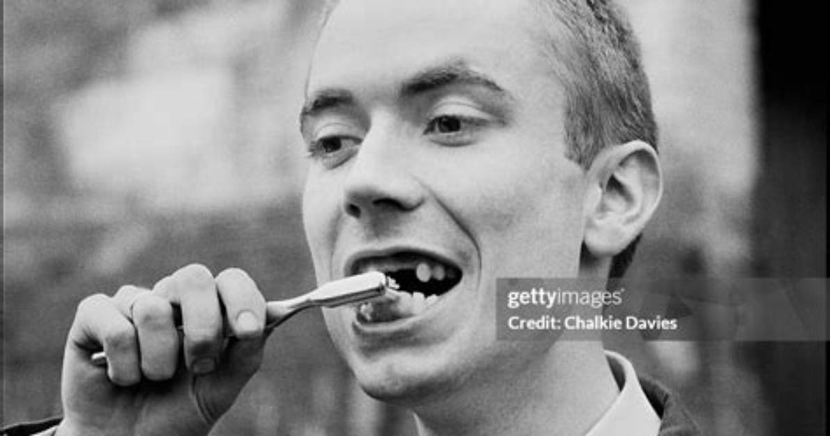 What Happened to Jerry Dammers’ Teeth? Is This the Cause of an Horrible Accident?