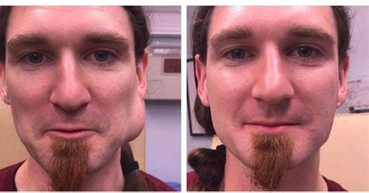 What Happened to Kevin Olaeta? Dr Pimple Popper Patient Passed Away