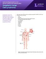 What Is Angioimmunoblastic T-Cell Lymphoma? Jurassic Park Actor Sam Neill Being Treated for Stage-Three Blood Cancer