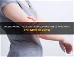 What You Need to Know About Swollen Virchow's Node Cancer