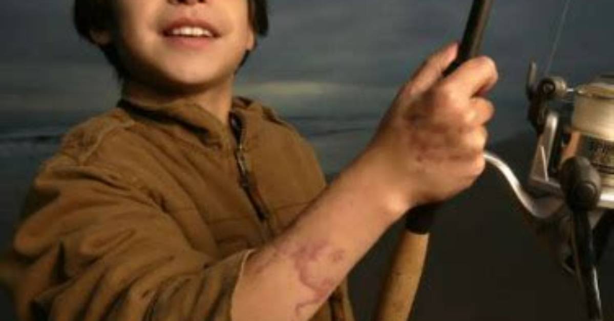 Where Is Aaron Perez Now? Shark Attack Survivor – Age Job and Wife Details