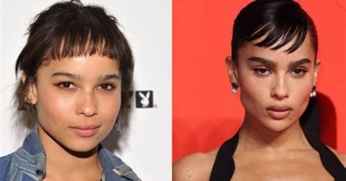 Zoe Kravitz's Plastic Surgery Journey: Uncovering the Truth